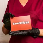 Asbestos Exposure Lawsuits: Securing Compensation After a Mesothelioma Diagnosis