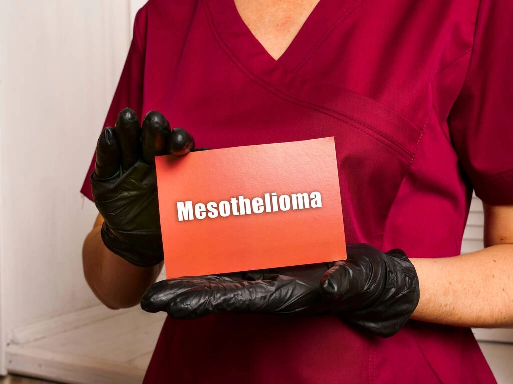 Asbestos Exposure Lawsuits: Securing Compensation After a Mesothelioma Diagnosis